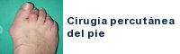 cirugía del pie