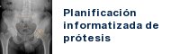 prótesis